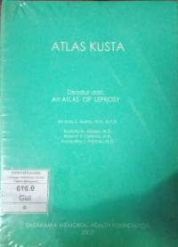 Image of Atlas Kusta